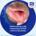 Aftamed Gel Forte - Per il trattamento di afte estese e molto dolorose - 8 ml Aftamed Gel Forte - Per il trattamento di afte estese e molto dolorose - 8 ml