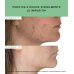Etat Pur Propoli 750ppm - Attivo antimperfezioni per pelle acneica - 15 ml