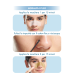 Miamo Blackhead Clear Duo Nose Mask - Maschera naso per punti neri - 5 maschere STEP 1 + 5 maschere STEP 2 + 10 cotton fiock