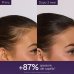 Caudalie Siero Capelli Anticaduta - Per la caduta dei capelli da stress, cambio di stagione o post-partum - 50 ml
