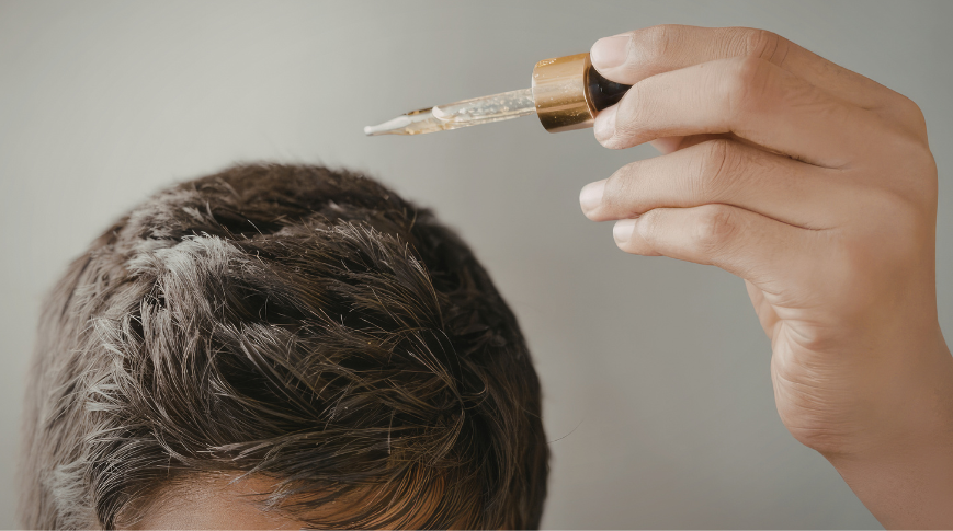 Come infoltire i capelli: cause del diradamento e soluzioni efficaci Come infoltire i capelli: cause del diradamento e soluzioni efficaci